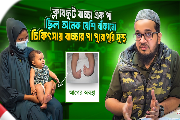 Clubfoot patient treatment